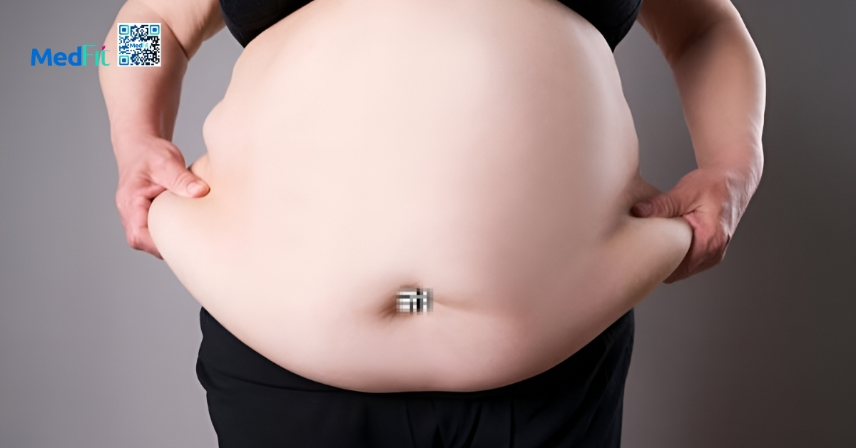 Mối liên quan giữa béo phì và đái tháo đường 1 tình trạng béo phì (hình minh họa)