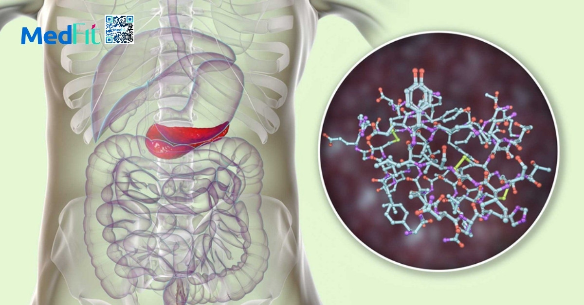 Mối liên quan giữa béo phì và đái tháo đường 3 insulin được sản xuất ở tuyến tụy