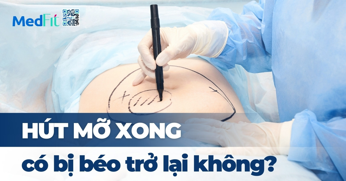 hút mỡ xong có bị béo trở lại không?