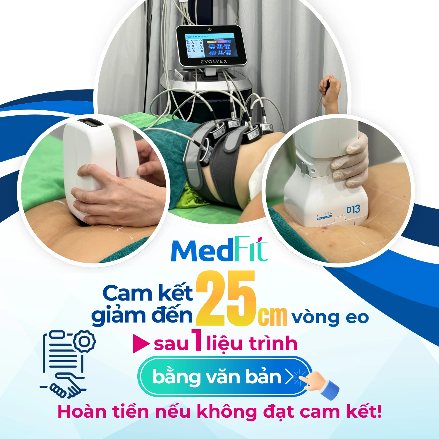 Banner cam kết giảm 25cm vòng eo m