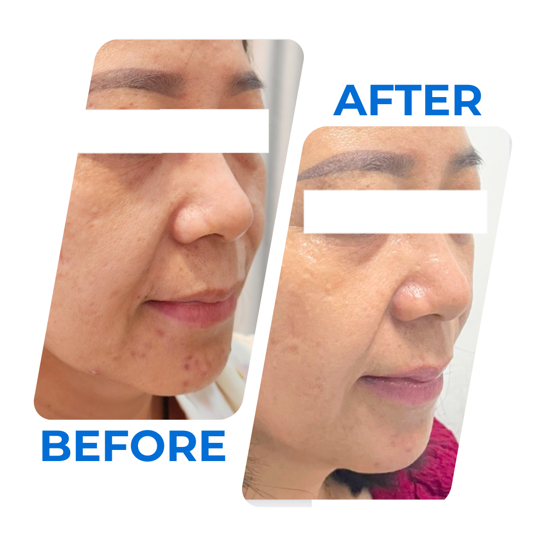 LỢI ÍCH forma