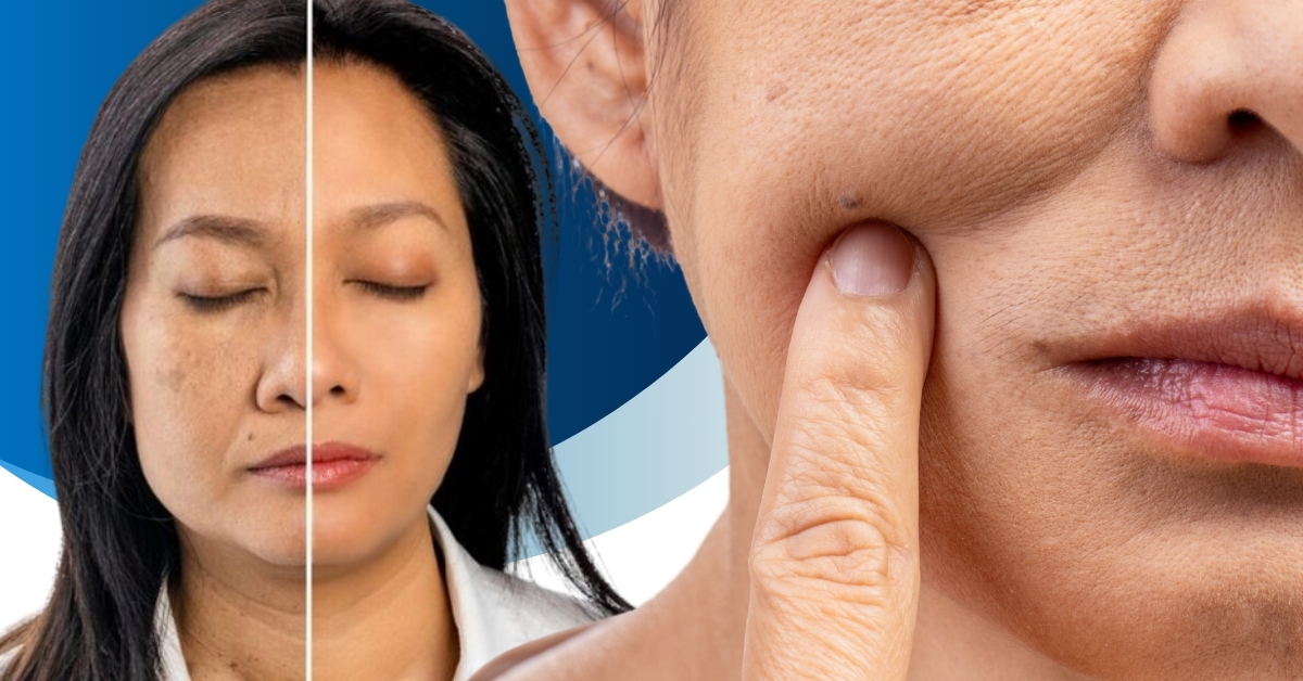 Người có khuôn mặt lão hóa, da chảy xệ