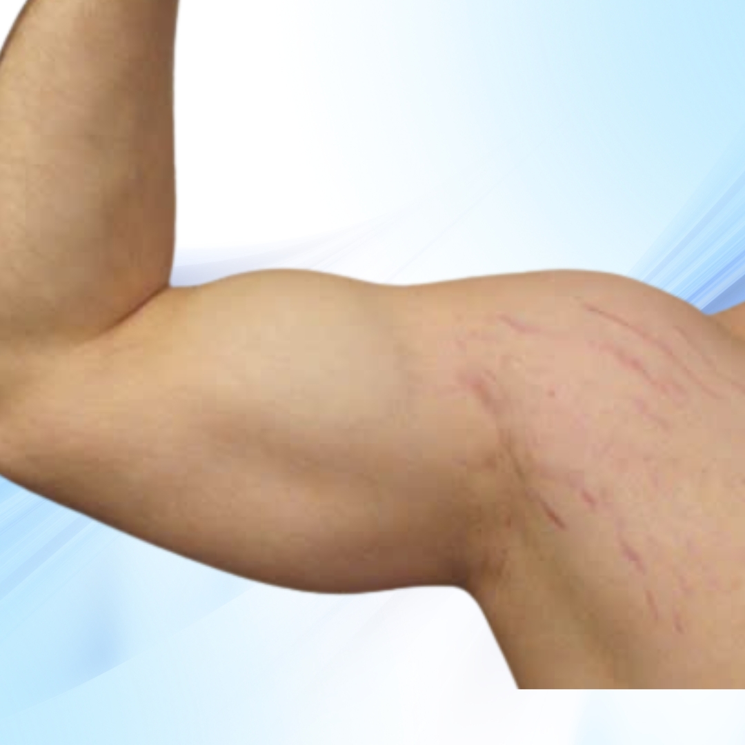 Tăng cơ tập gym Tăng cơ tập gym