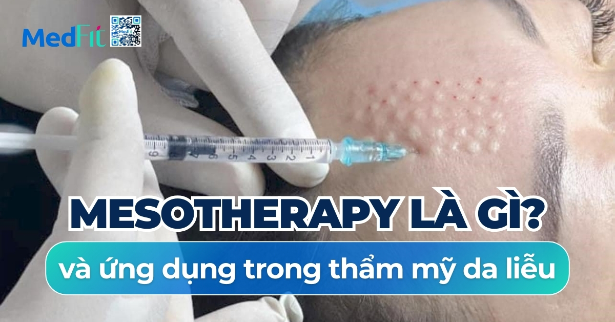 mesotherapy là gì và ứng dụng trong thẩm mỹ