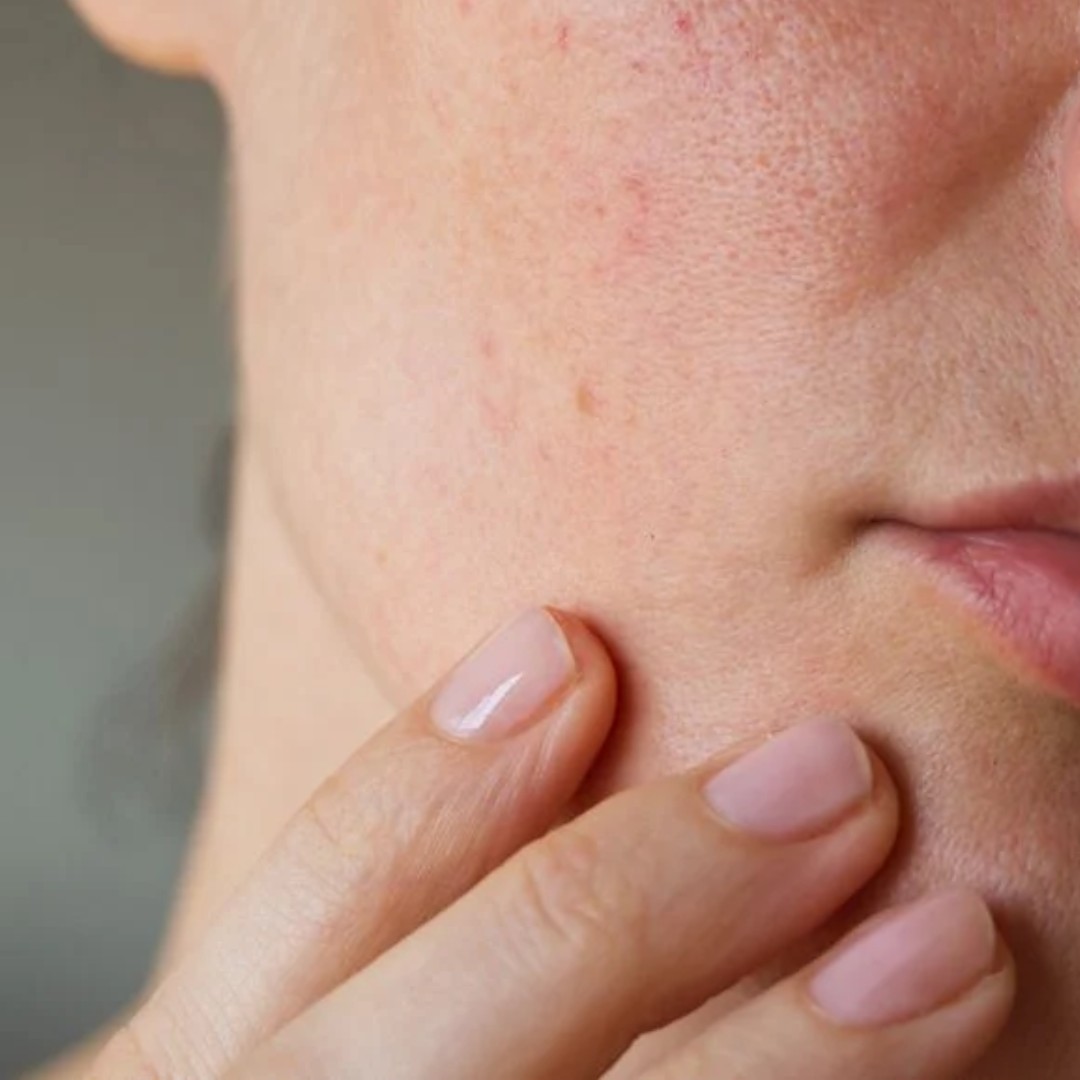 Rejuran Healer – Giải pháp trẻ hóa và tái tạo, phục hồi làn da 6