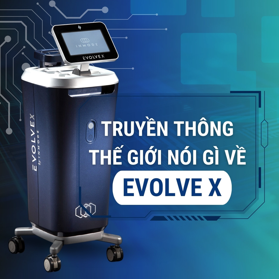 Truyền thông nói gì về Evolve X