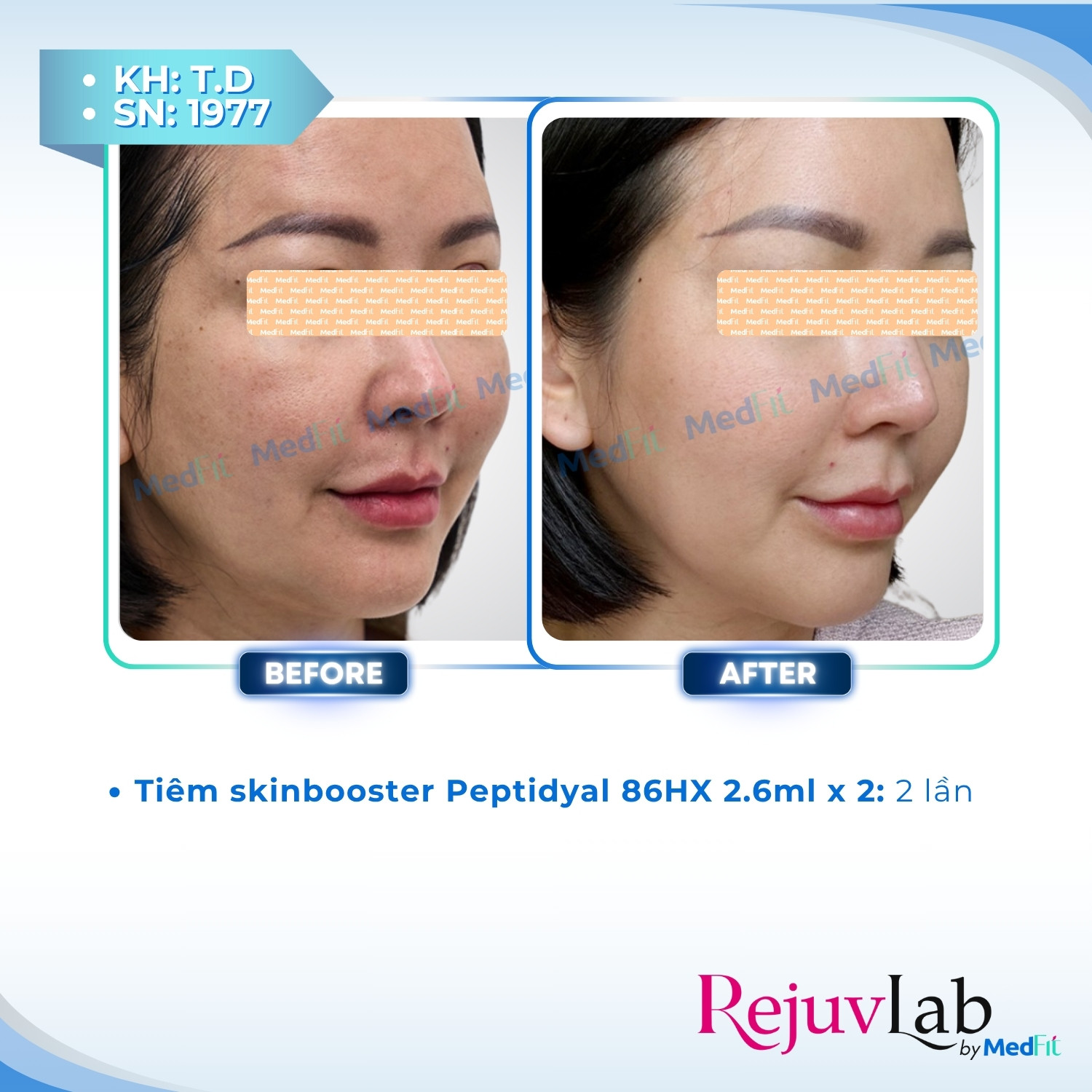 Peptidyal®86HX – Công thức tái tạo làn da tươi trẻ 3
