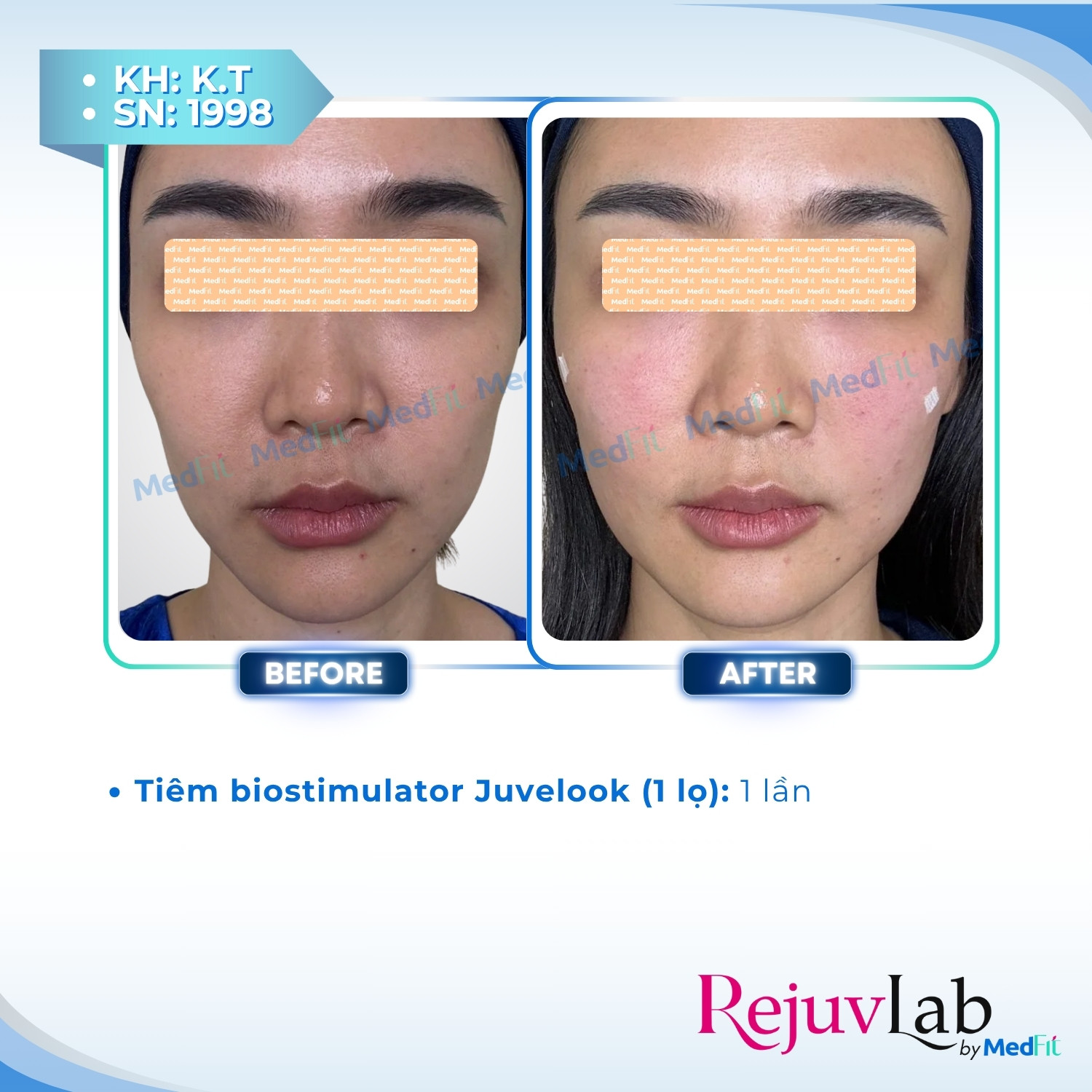 Juvelook - Khám phá vẻ đẹp tự nhiên và tươi trẻ 5