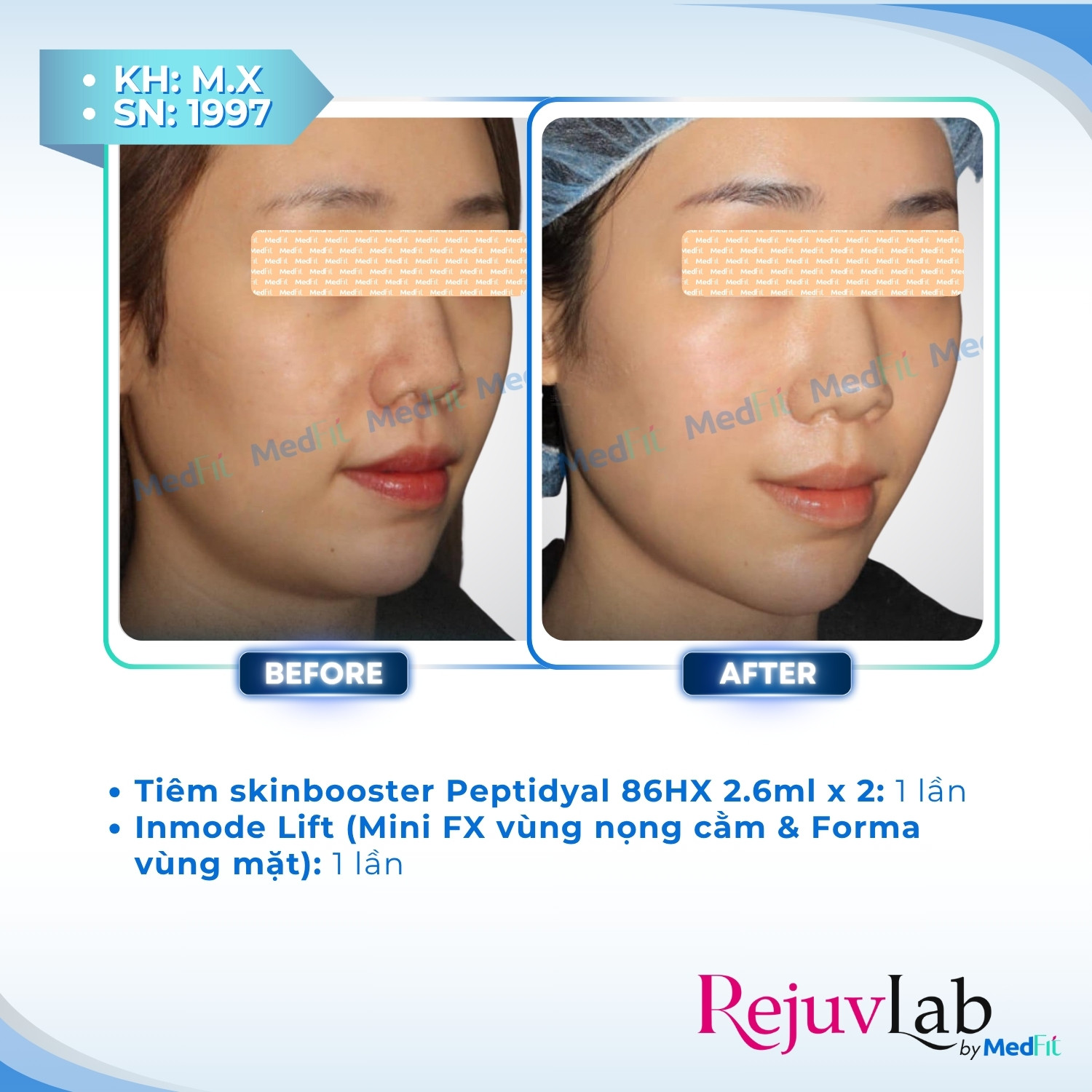 Peptidyal®86HX – Công thức tái tạo làn da tươi trẻ 4