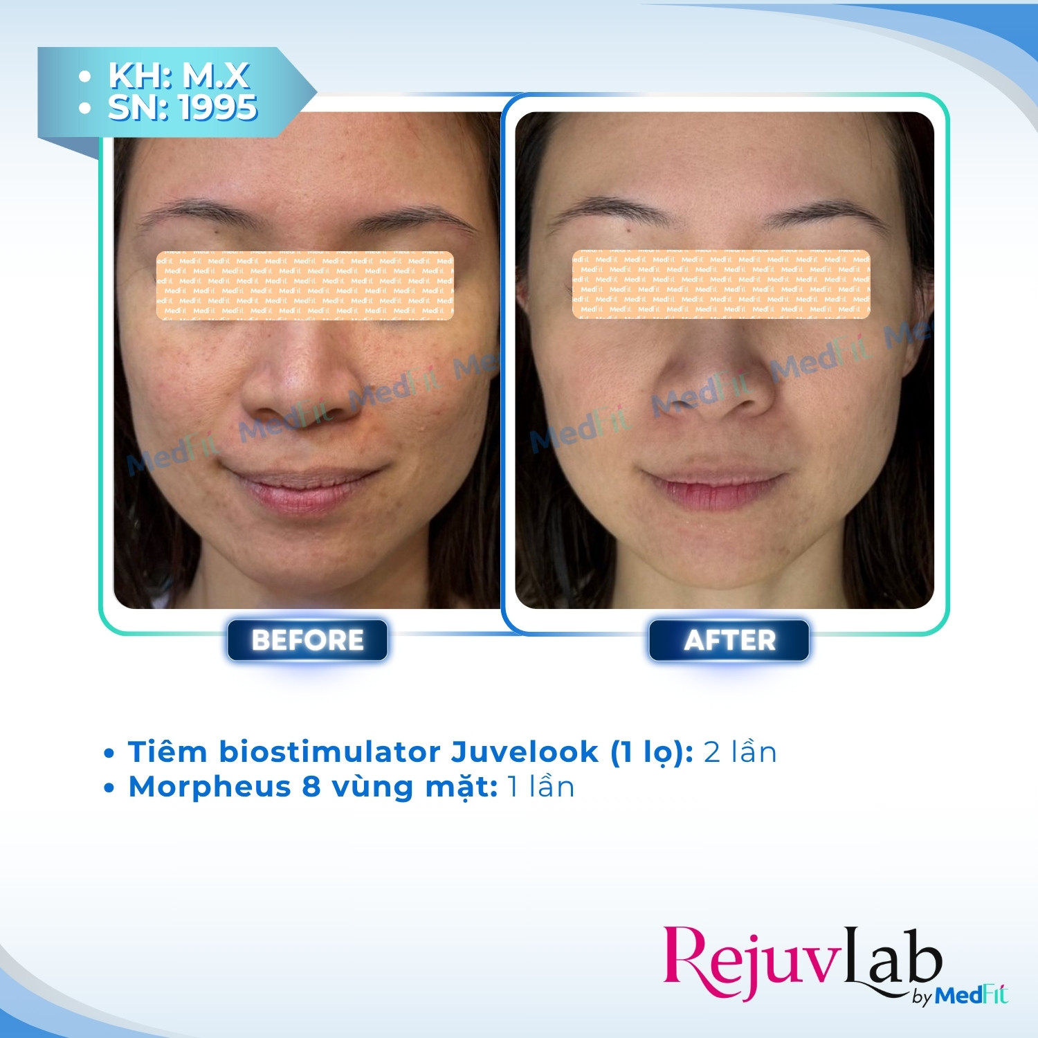 Juvelook - Khám phá vẻ đẹp tự nhiên và tươi trẻ 6