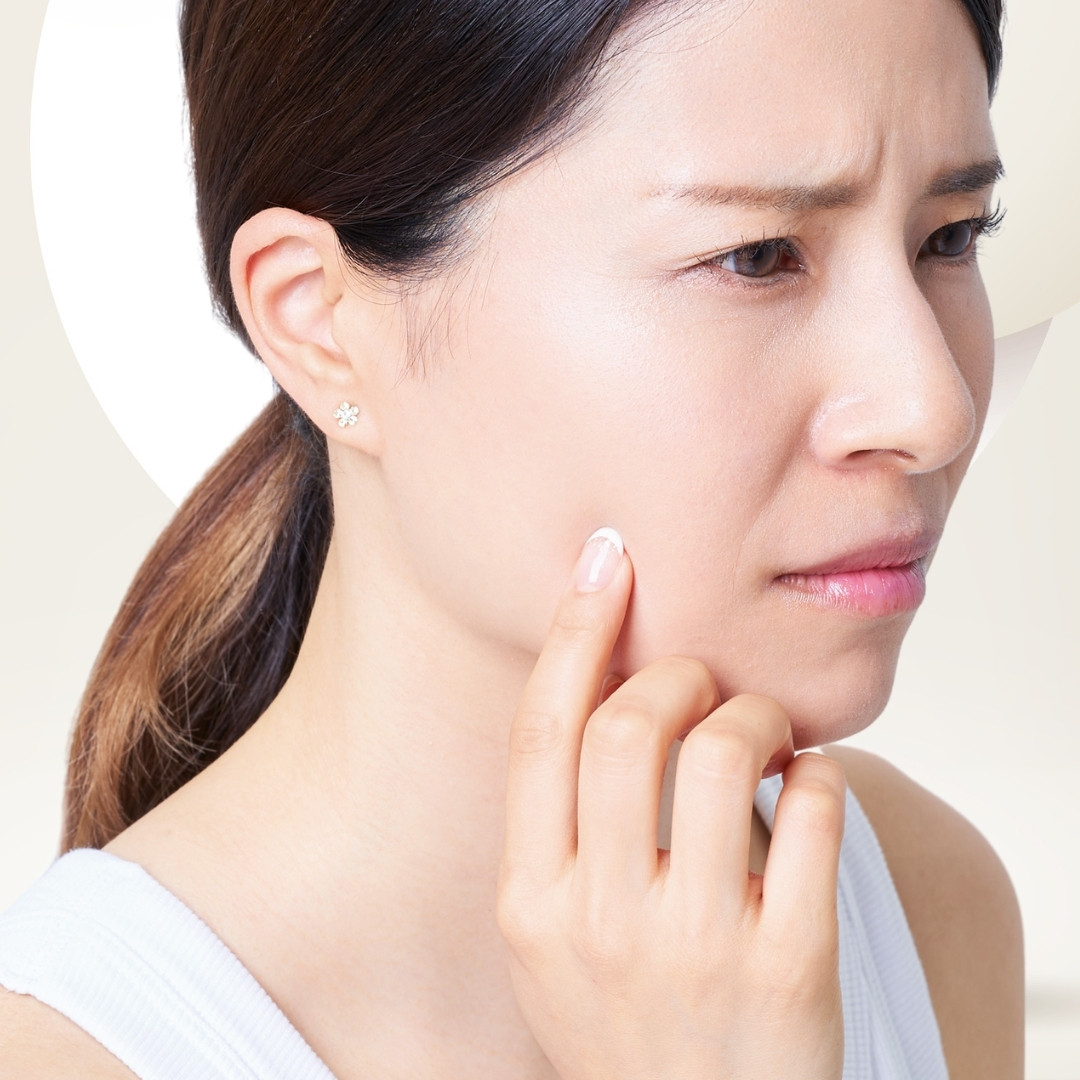 Profhilo Structura – Phương pháp cấp ẩm và trẻ hóa mô mỡ với hyaluronic acid 5