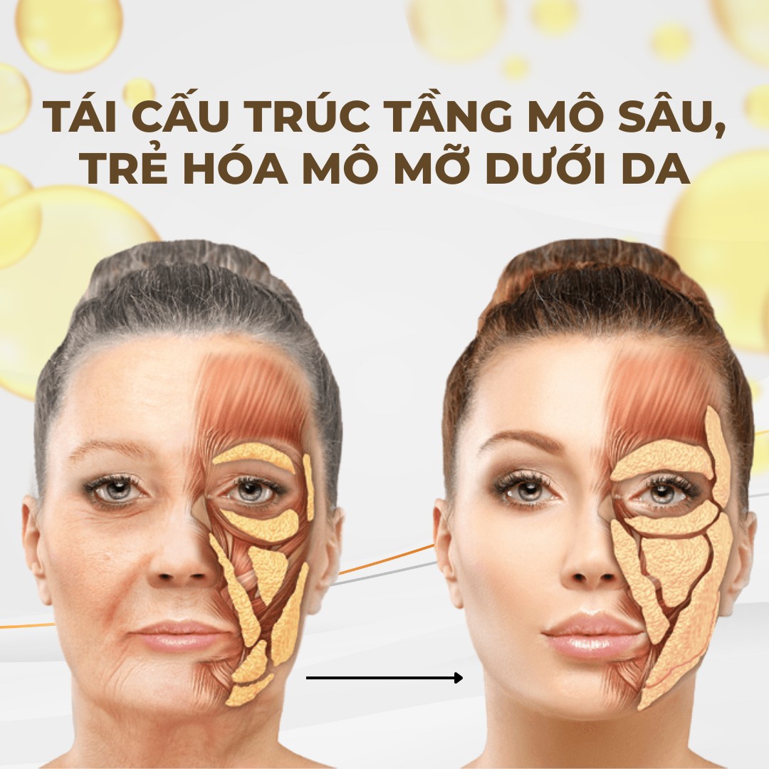 Tái cấu trúc mô mỡ
