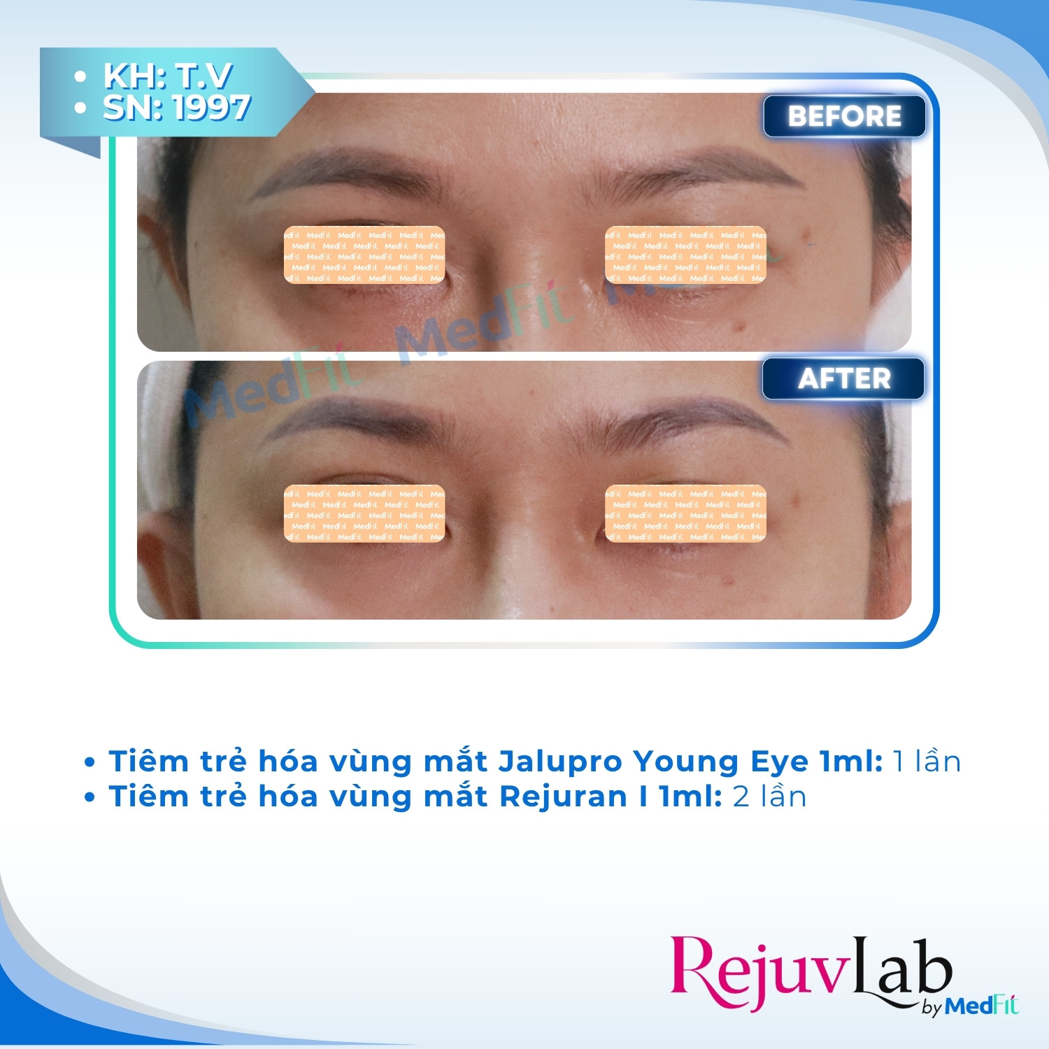 Thẩm mỹ da 9