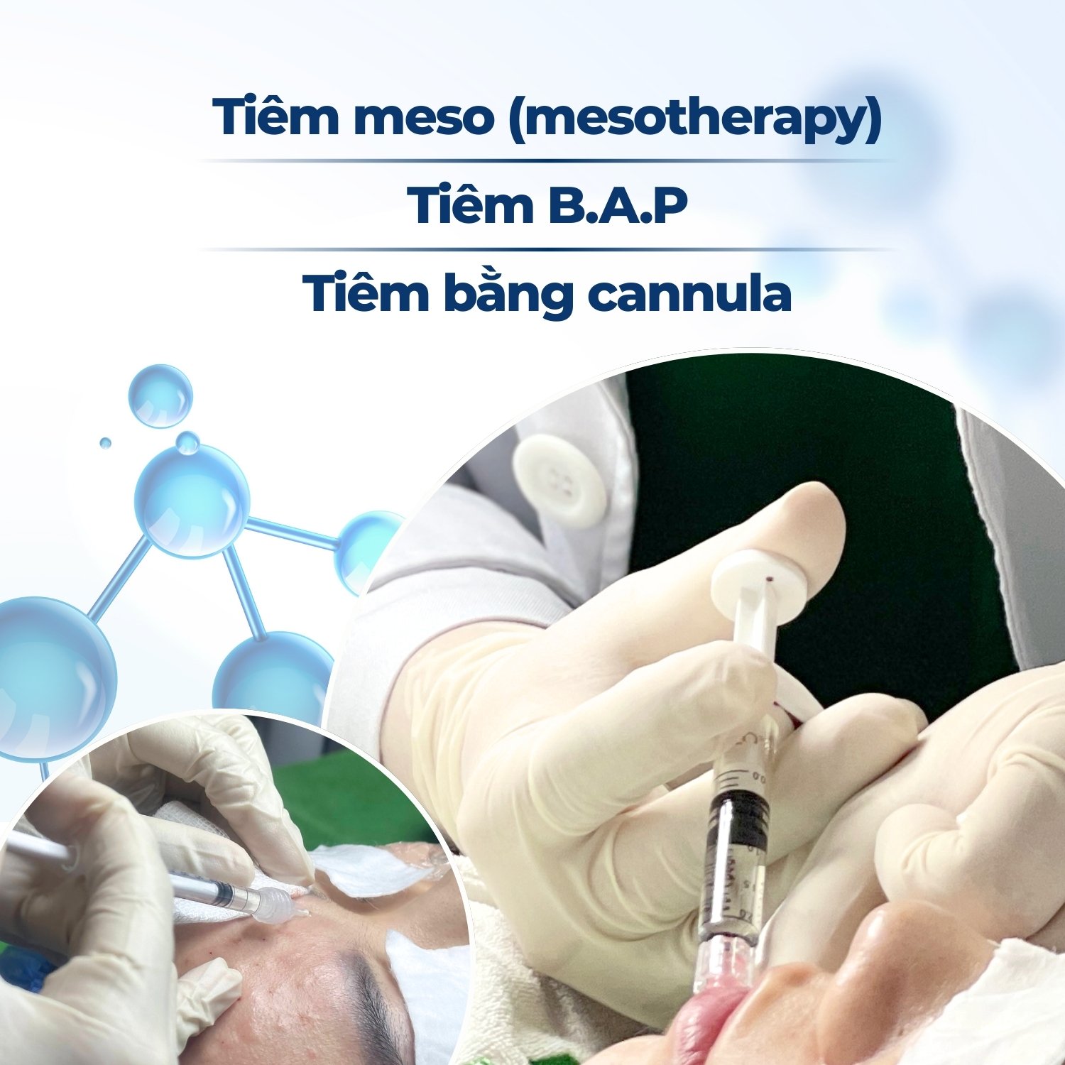 Banner các kỹ thuật tiêm meso, BAP, cannula - Mobile
