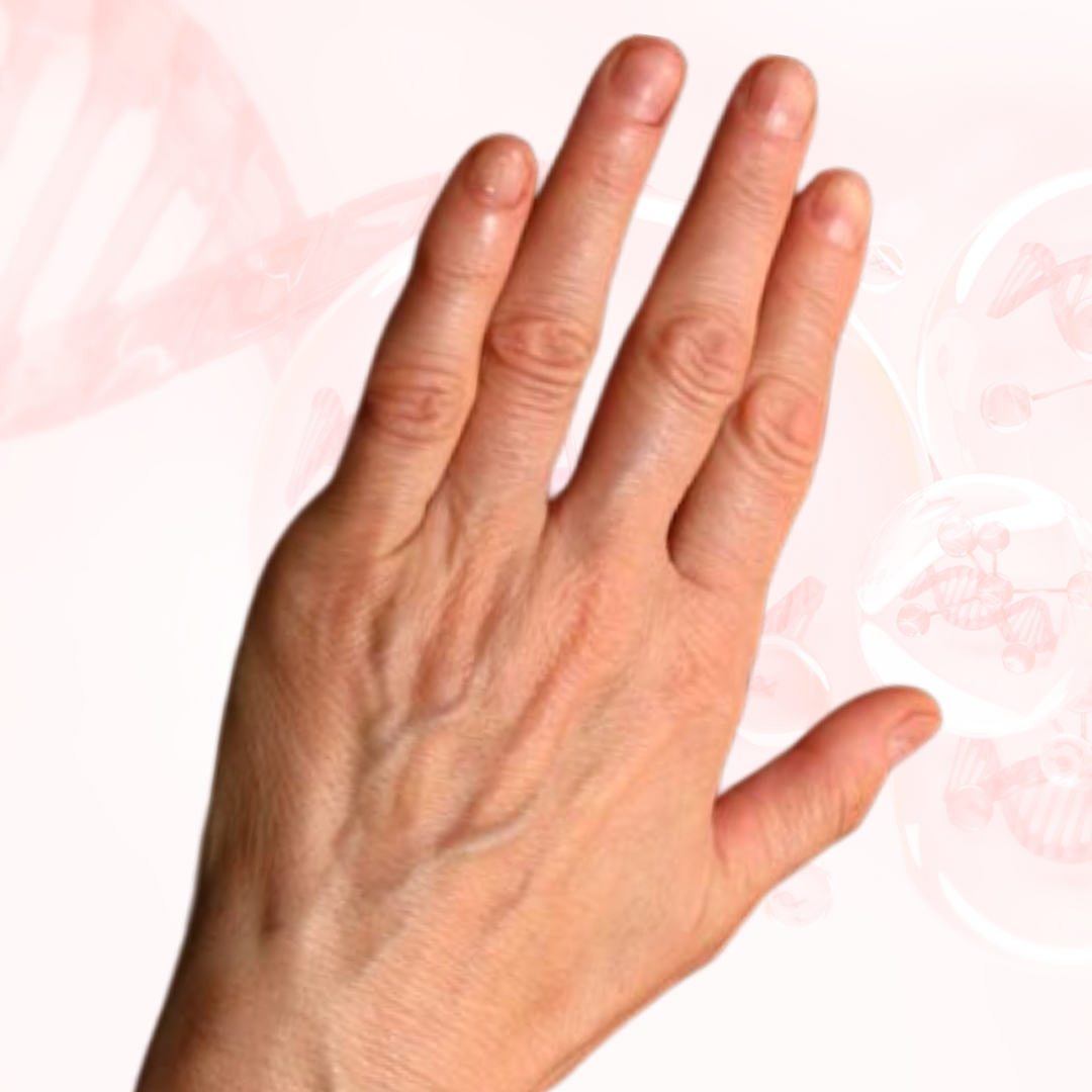Trước