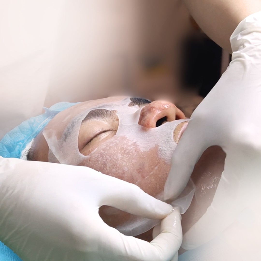 Bước 4 Bước 4