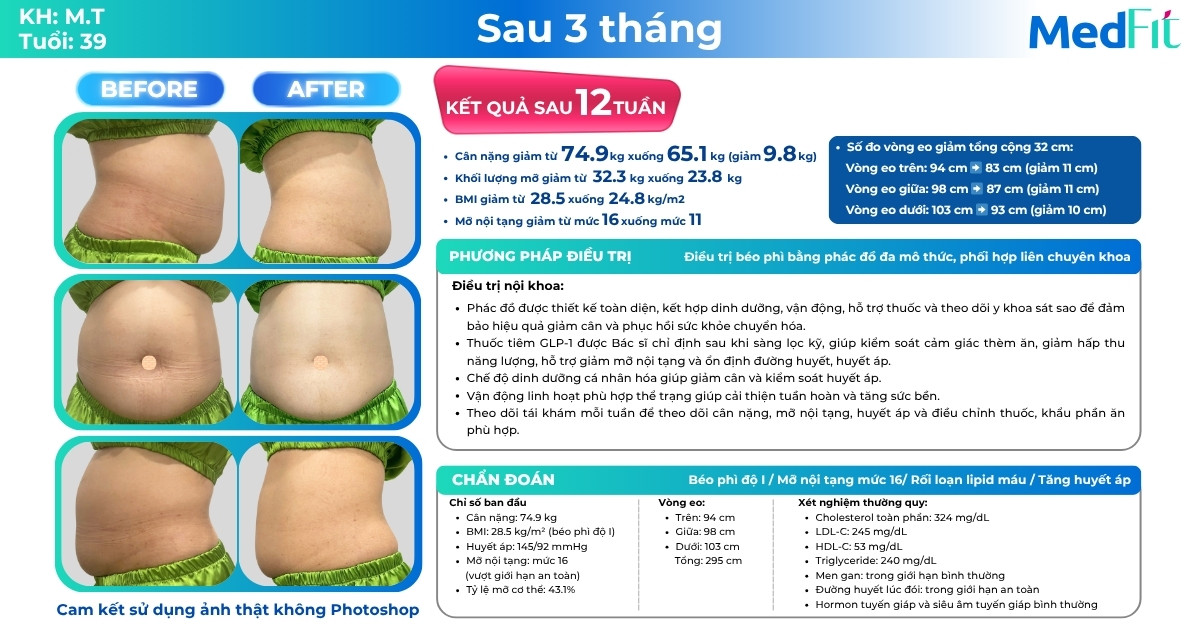 Có cần ăn kiêng để giảm cân không? 11 Có cần ăn kiêng để giảm cân không? 10