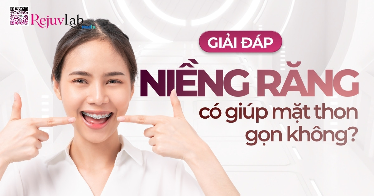 Trang chủ 76