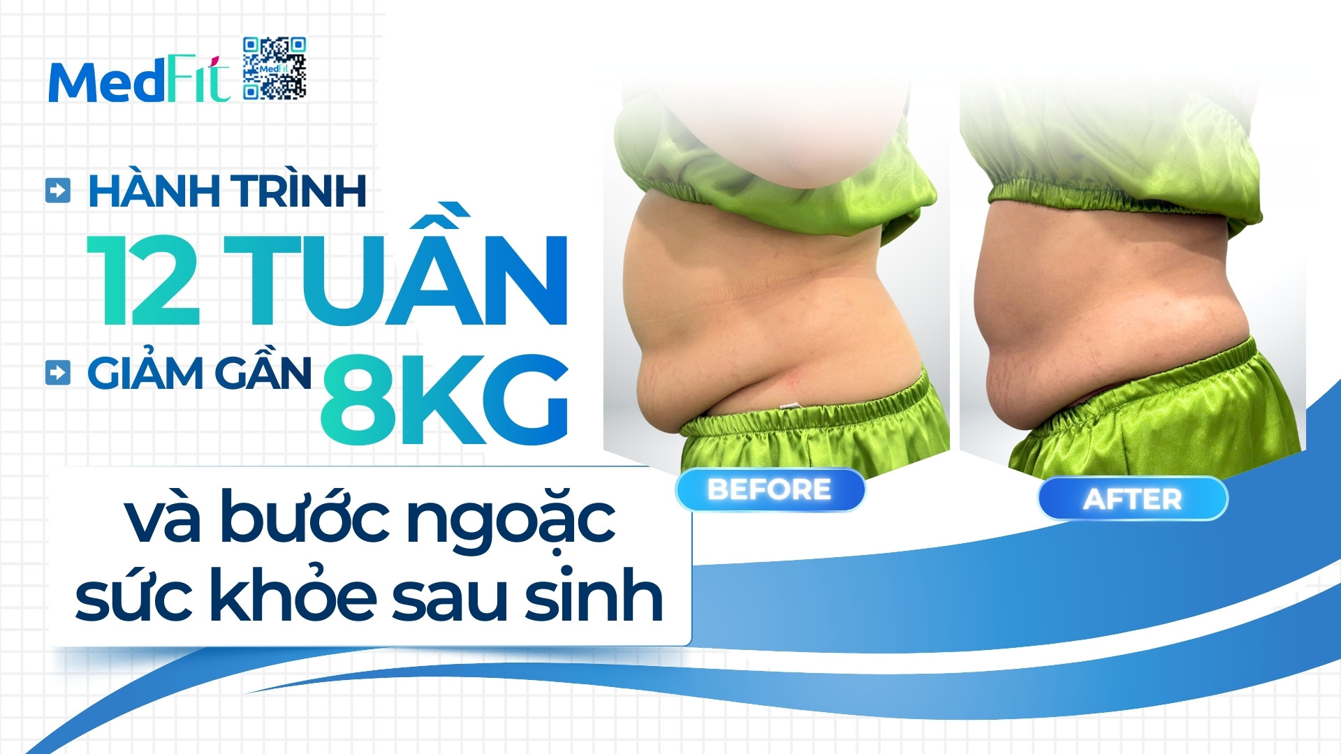 Thumb clip khách N.T