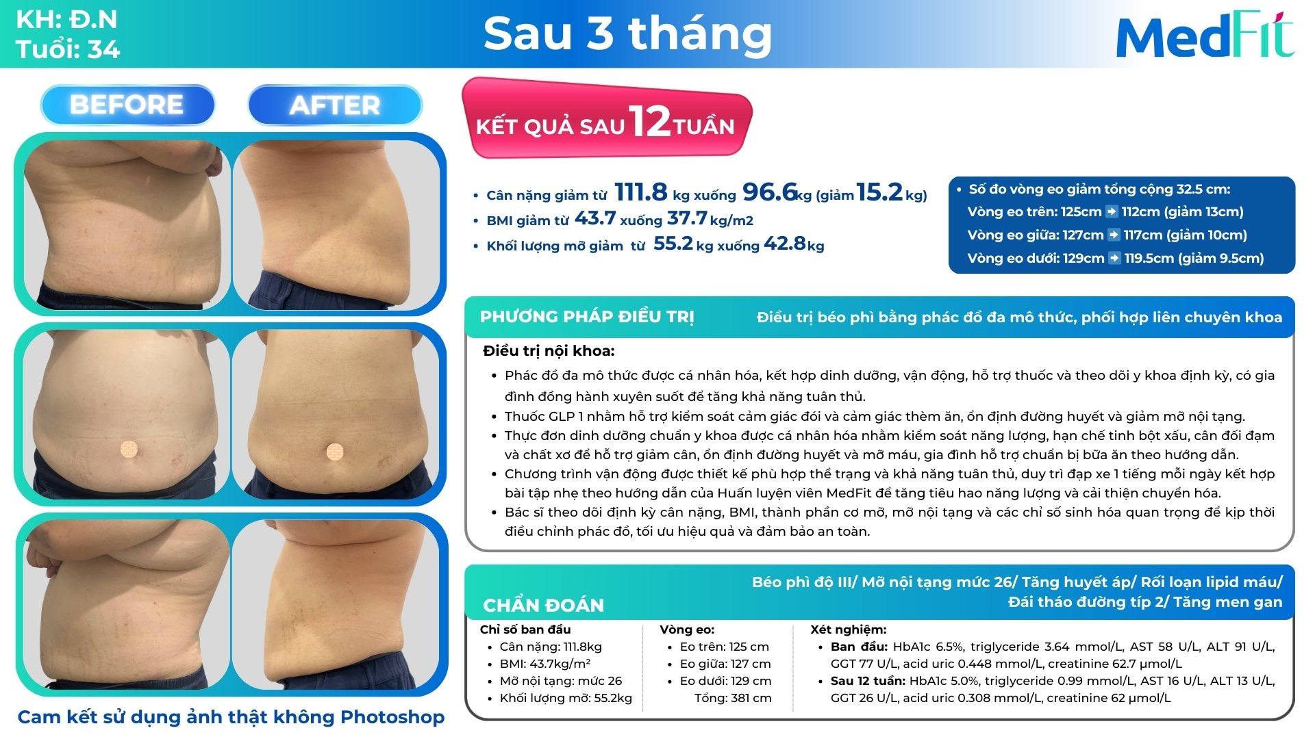 Ca lâm sàng giảm cân tại Phòng khám MedFit