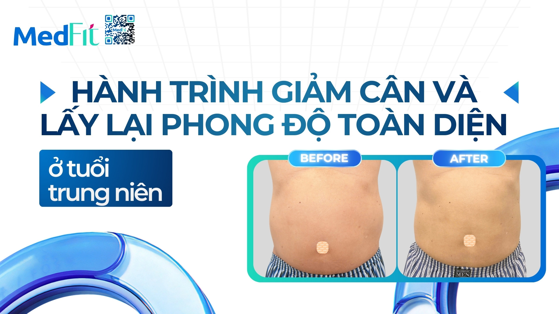 Thumb clip A.H