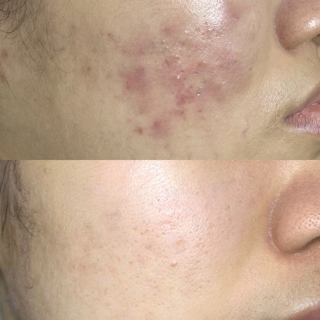 Da được tái tạo và phục hồi sau tổn thương