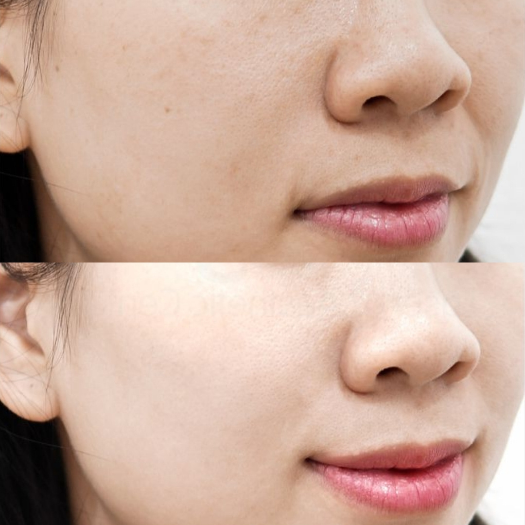 Da săn chắc đàn hồi hơn