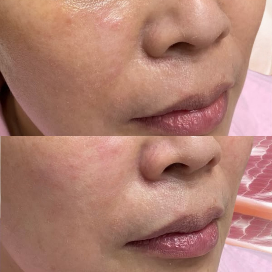 Da săn chắc và đàn hồi hơn