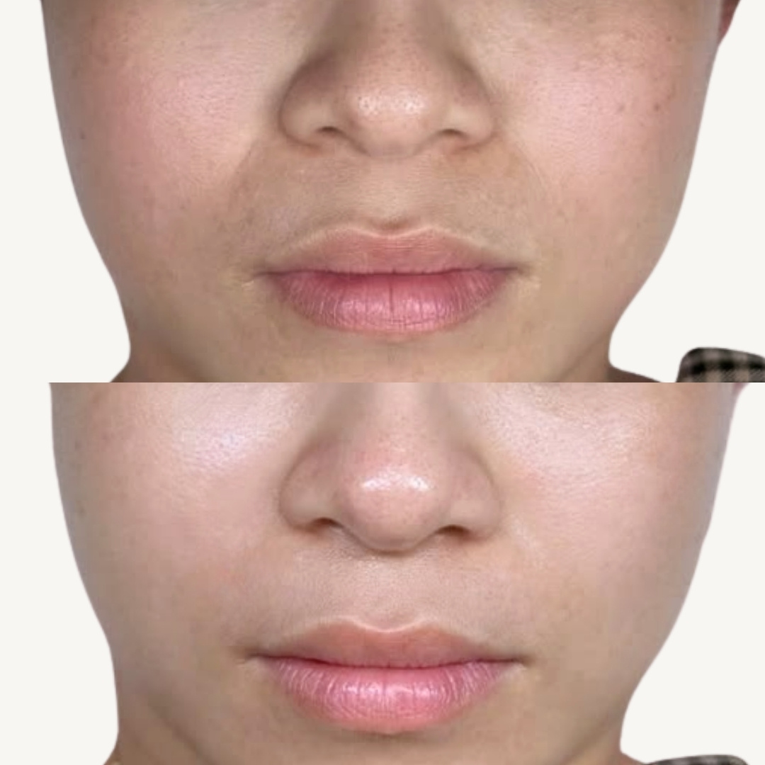 Hiệu ứng trẻ hóa tự nhiên