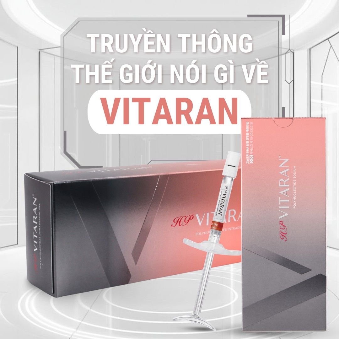 Truyền thông nói gì về Vitaran