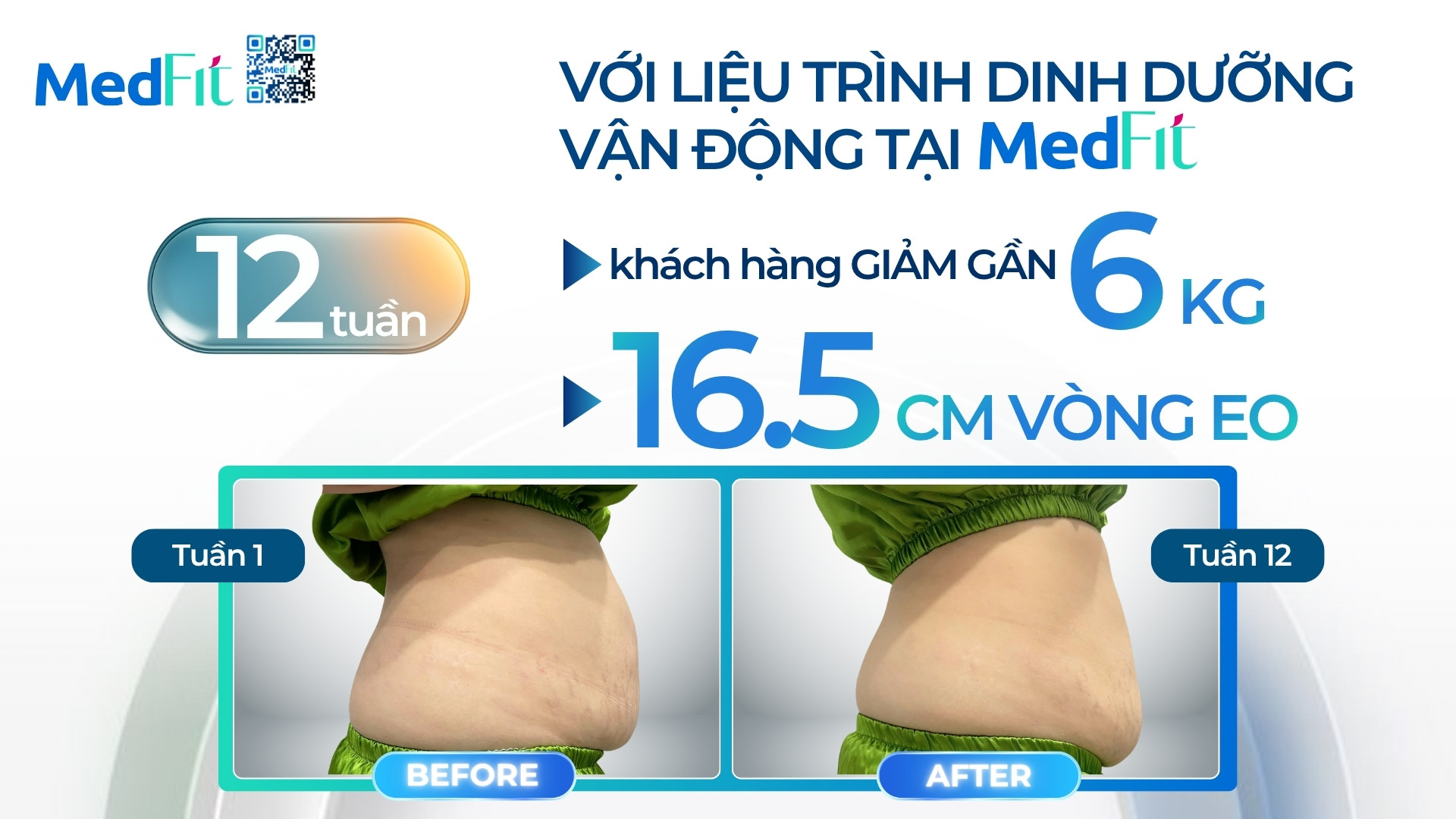 Thumb clip kh D.H