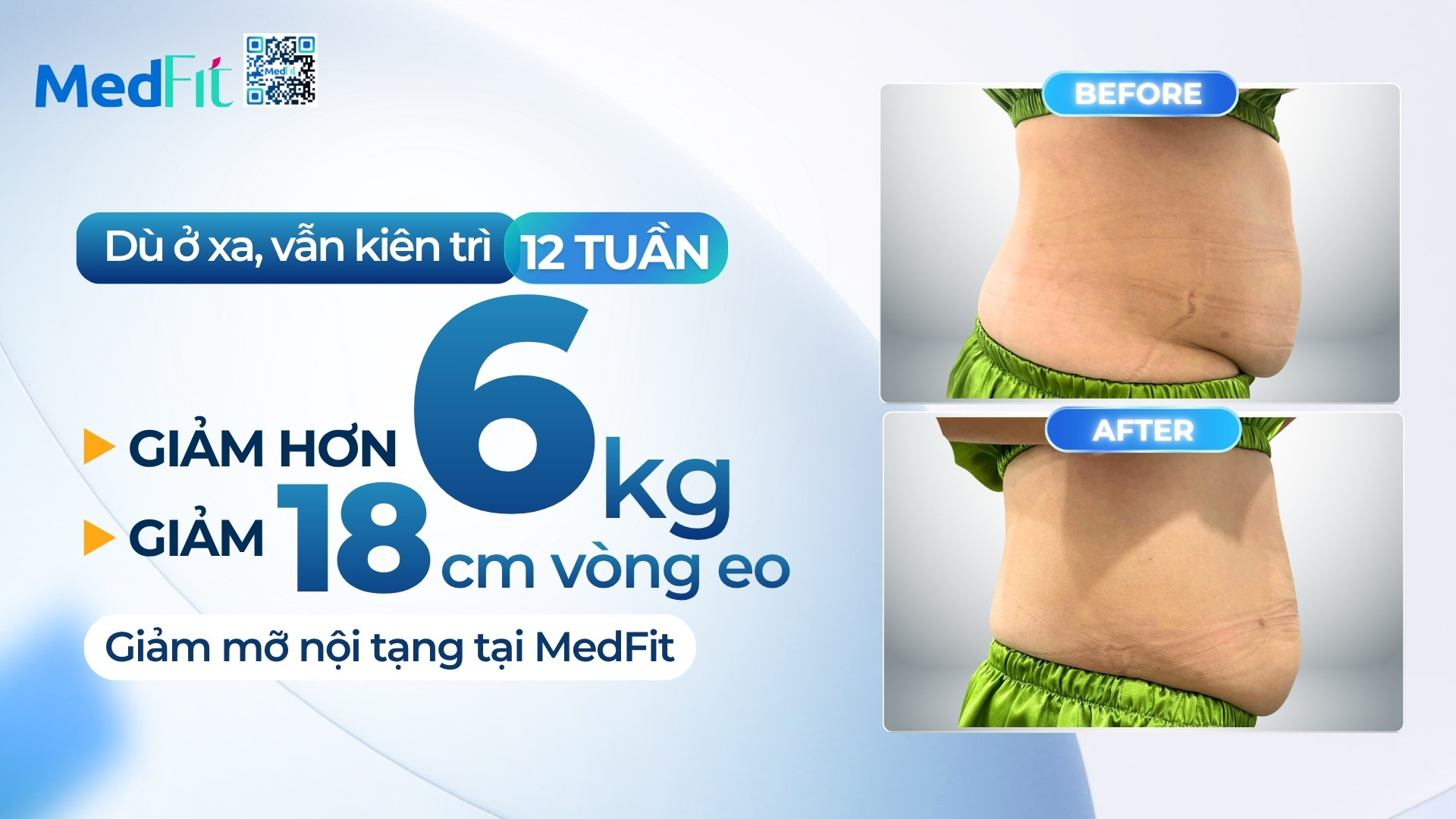 Thumb clip kh T.M