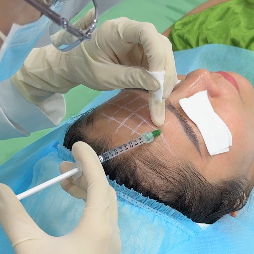Nâng cơ và trẻ hóa da - căn chỉnh khuôn mặt 55