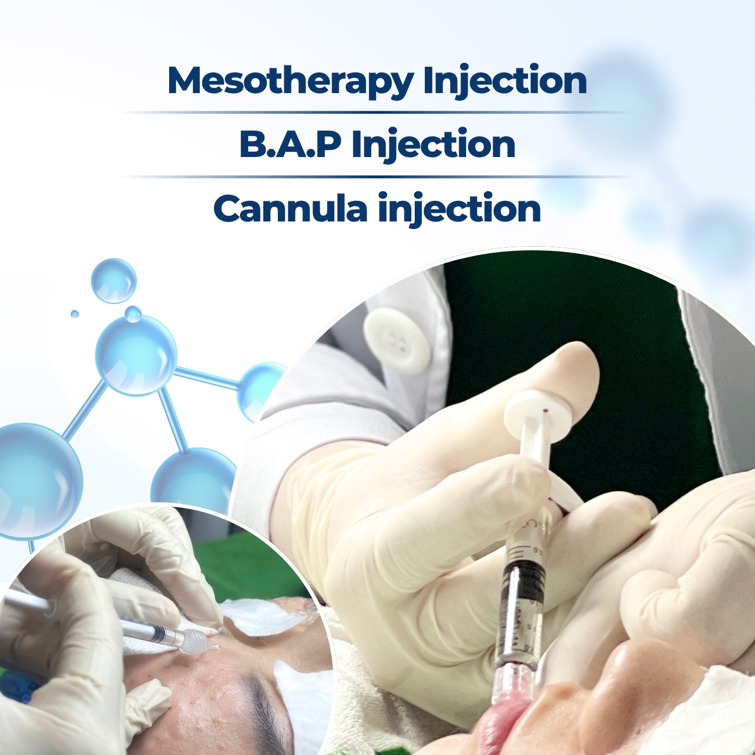 Banner các kỹ thuật tiêm meso, BAP, cannula - Mobile - Tiếng anh Banner các kỹ thuật tiêm meso, BAP, cannula - Mobile - Tiếng anh