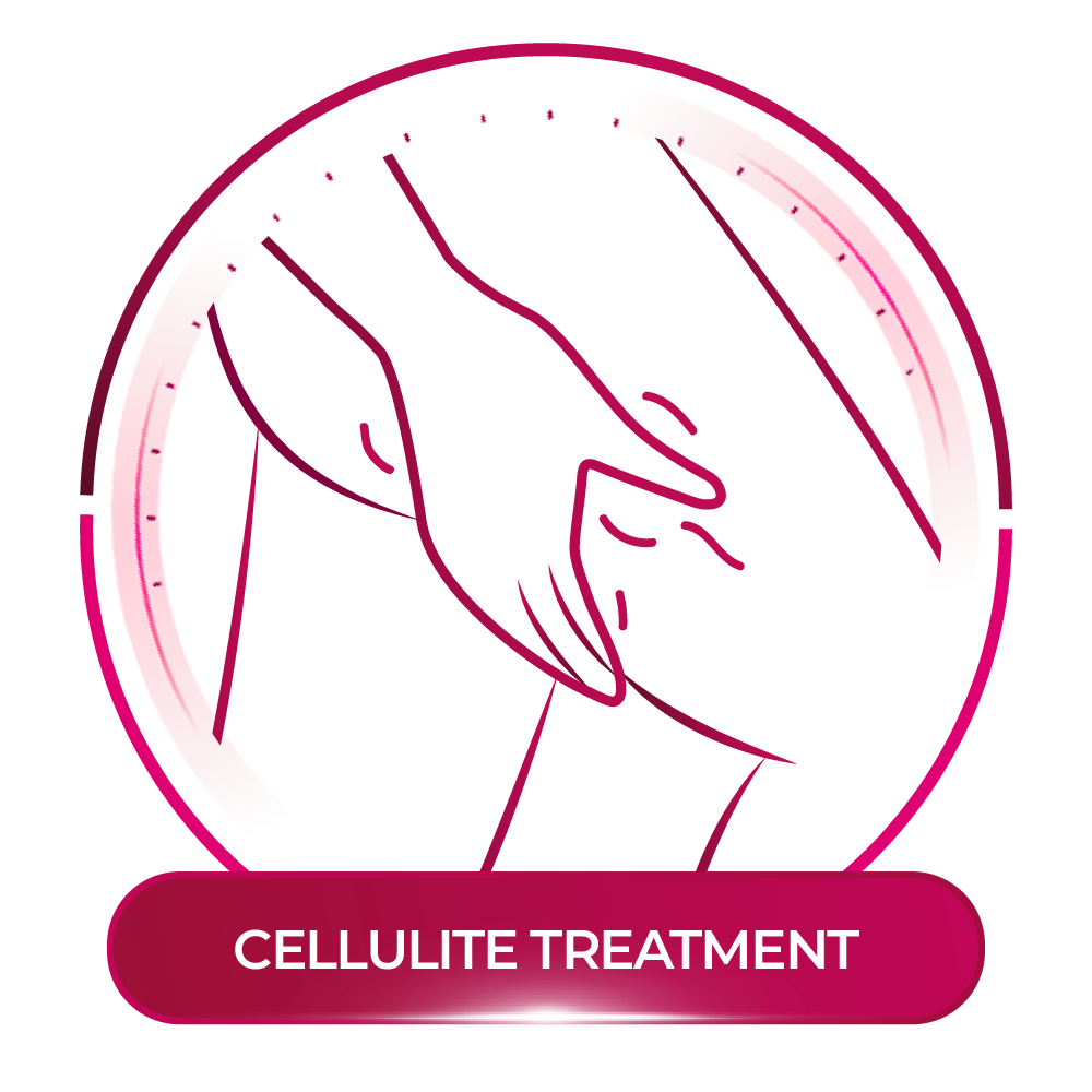 điều trị cellulite - ta