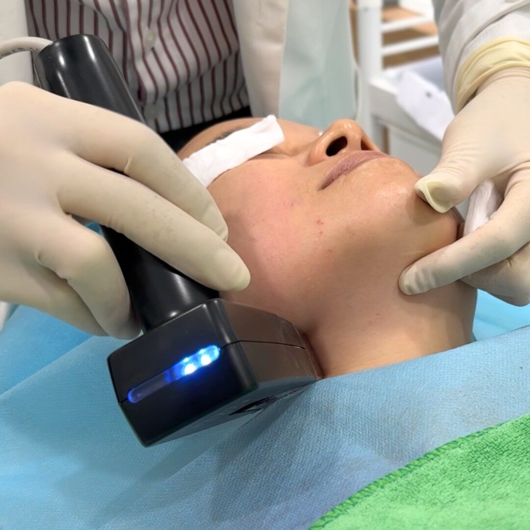 Bước 3