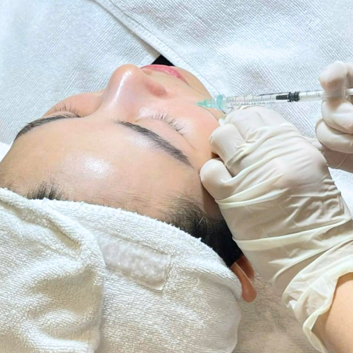 Cải thiện cấu trúc da
