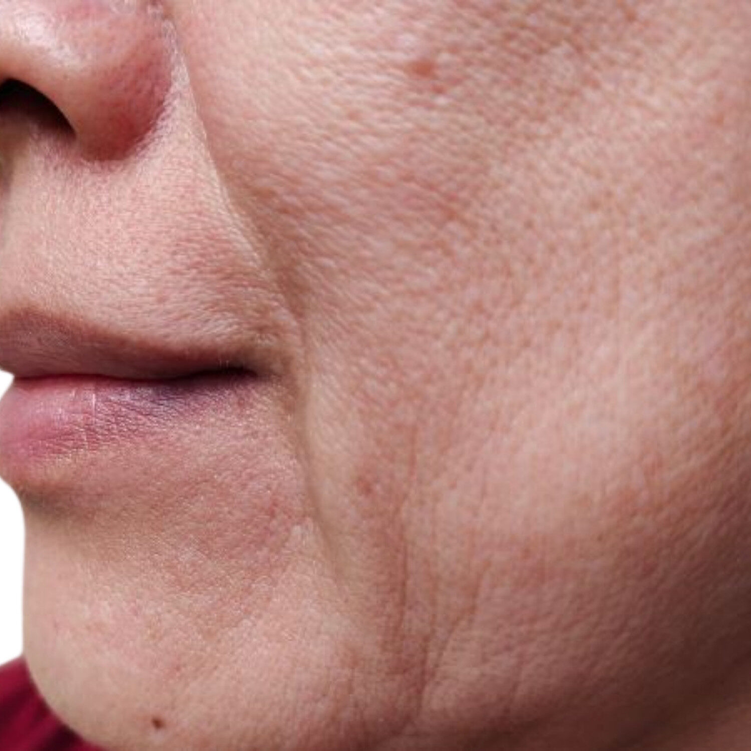 Da có nếp nhăn giảm đàn hồi
