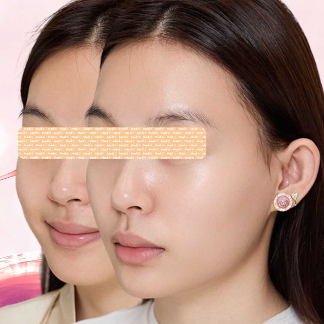 Hiệu quả duy trì lâu dài