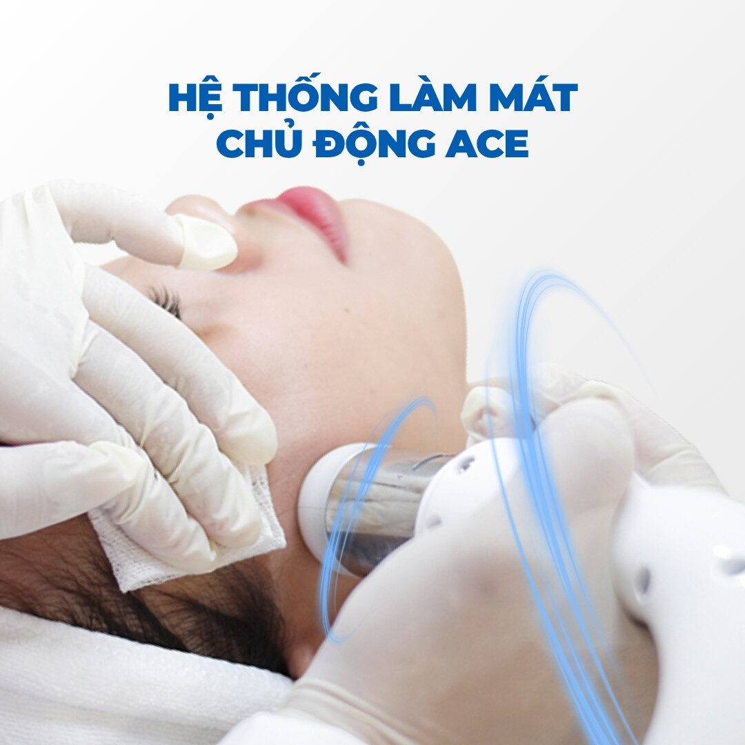 Làm mát chủ độgn ACE Làm mát chủ độgn ACE