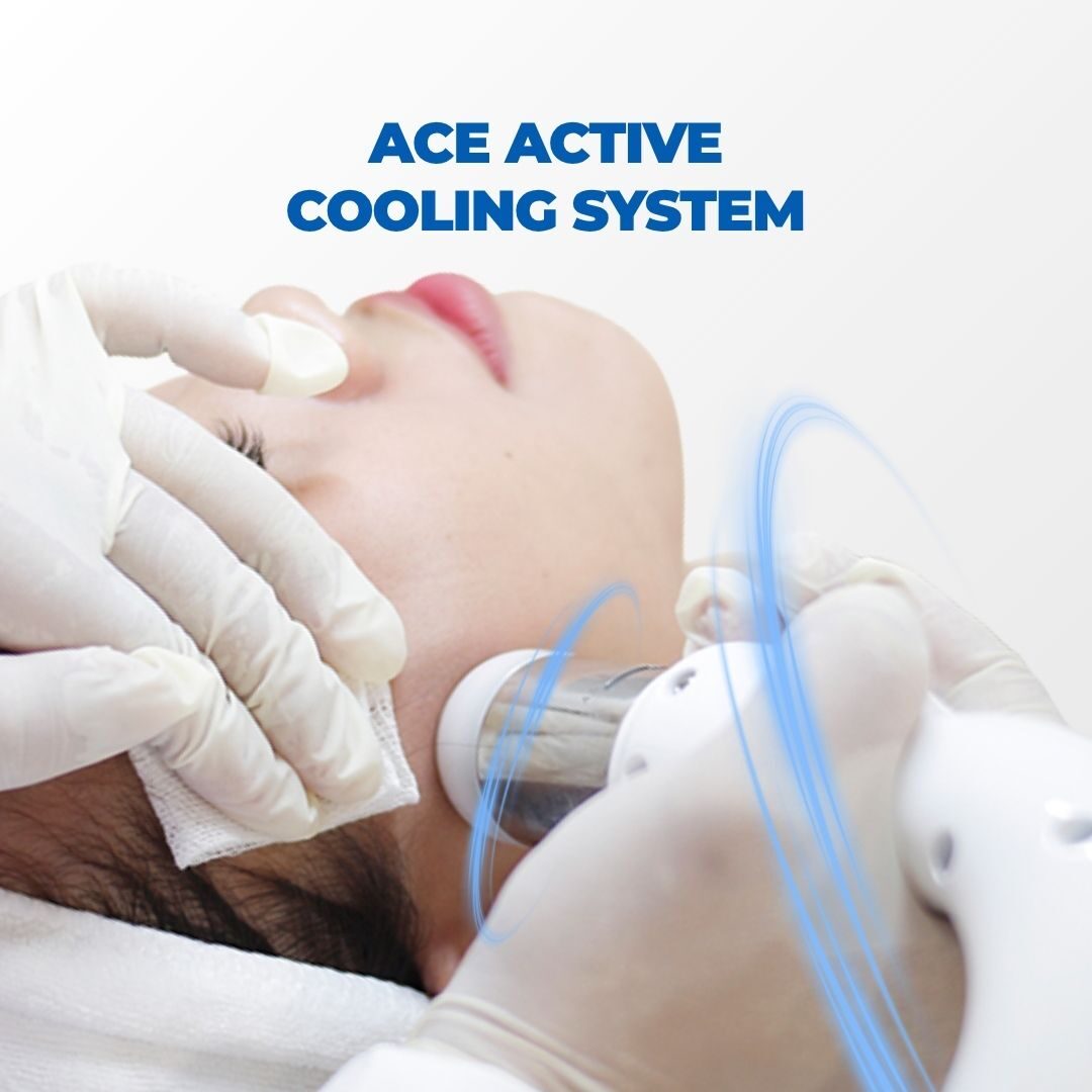 Làm mát chủ động ACE