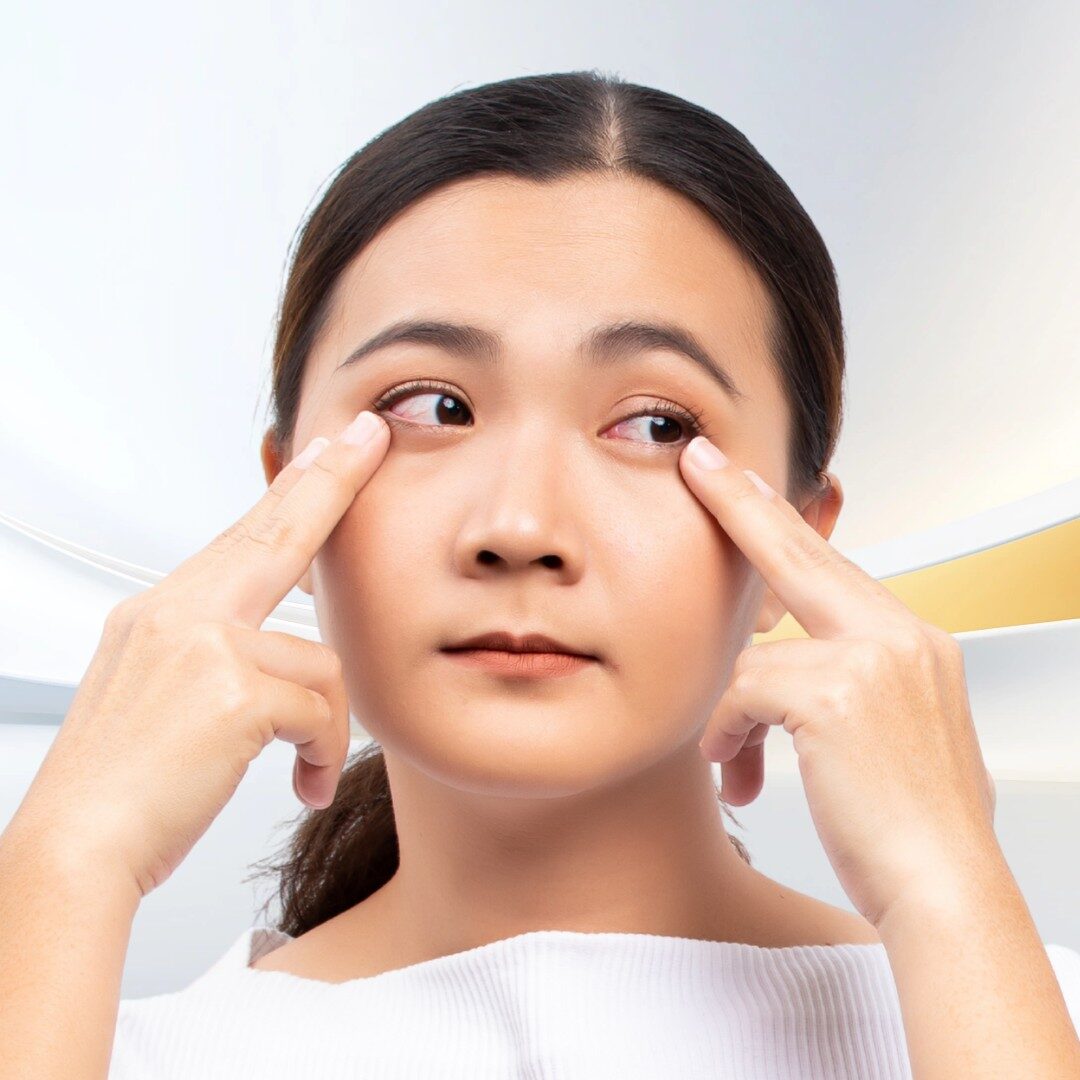 Người muốn trẻ hóa da vùng quanh mắt