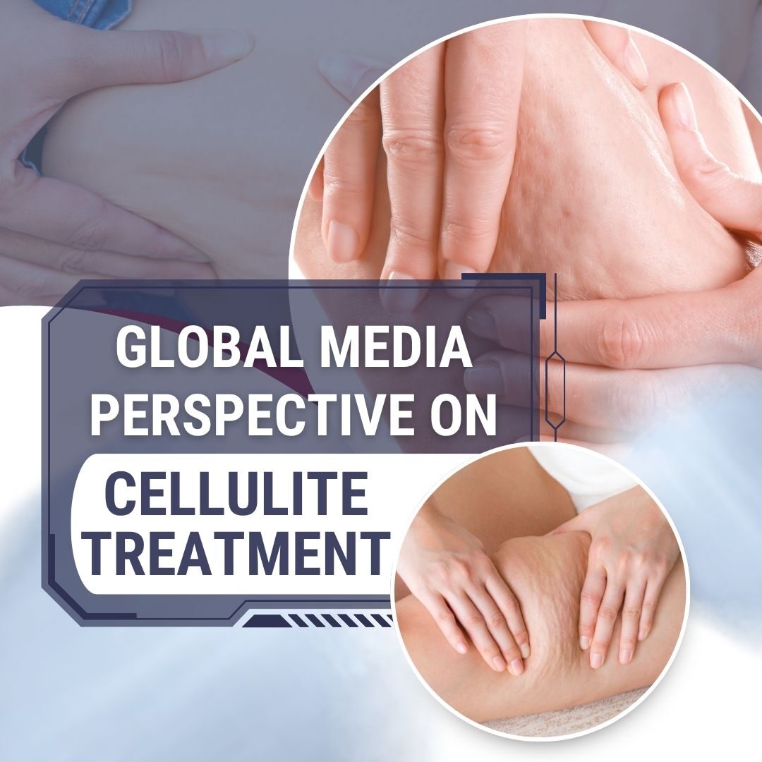 Truyền thông thế giới nói gì về điều trị cellulite - Tiếng anh