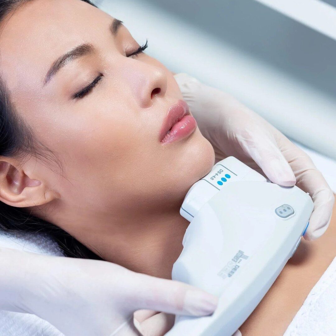 Ultherapy Prime