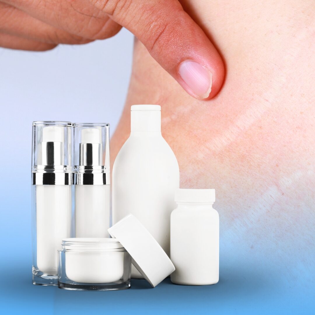 sản phẩm trị rạn da sản phẩm trị rạn da